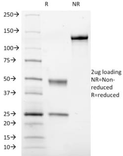 Mouse anti-Integrin alpha 2b/CD41, Clone: ITGA2B/1036, Novus Biologicals:Antibodies:Primary